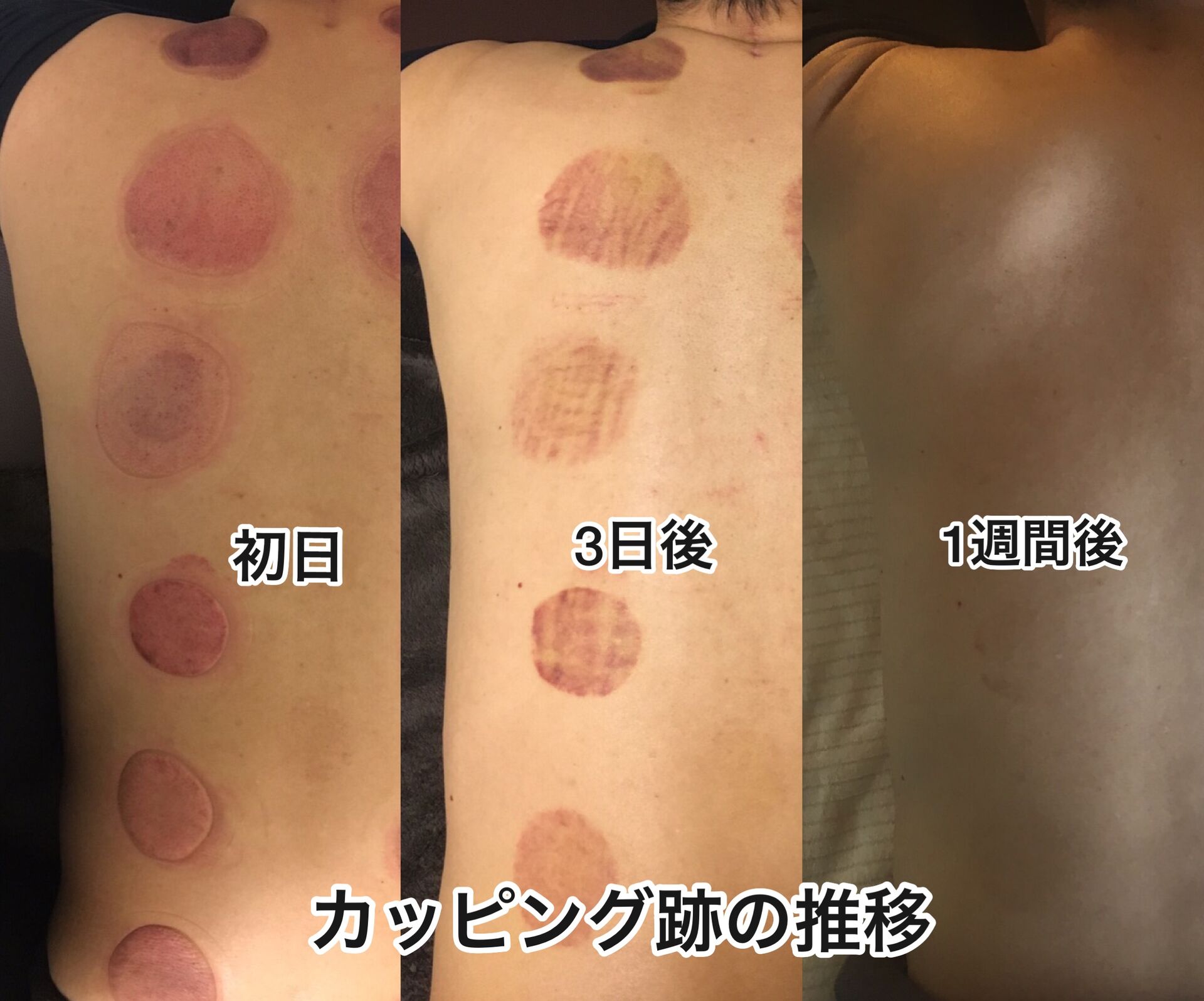 人気オプション カッピング
