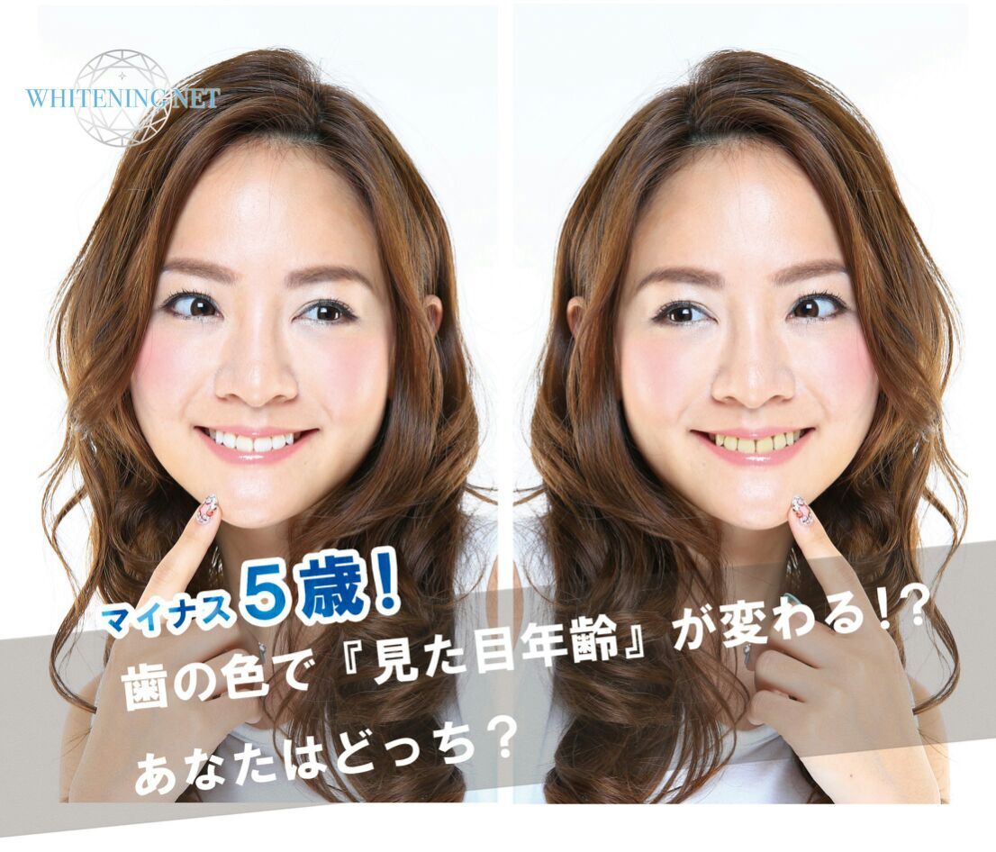 どこよりもお得に！セルフホワイトニング